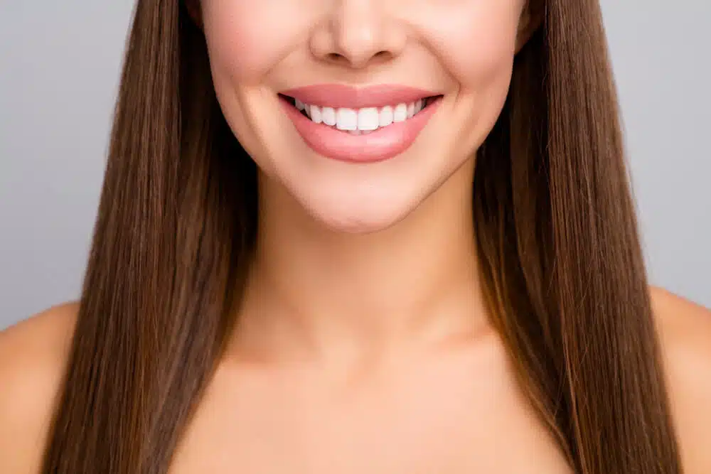 How to care for veneers