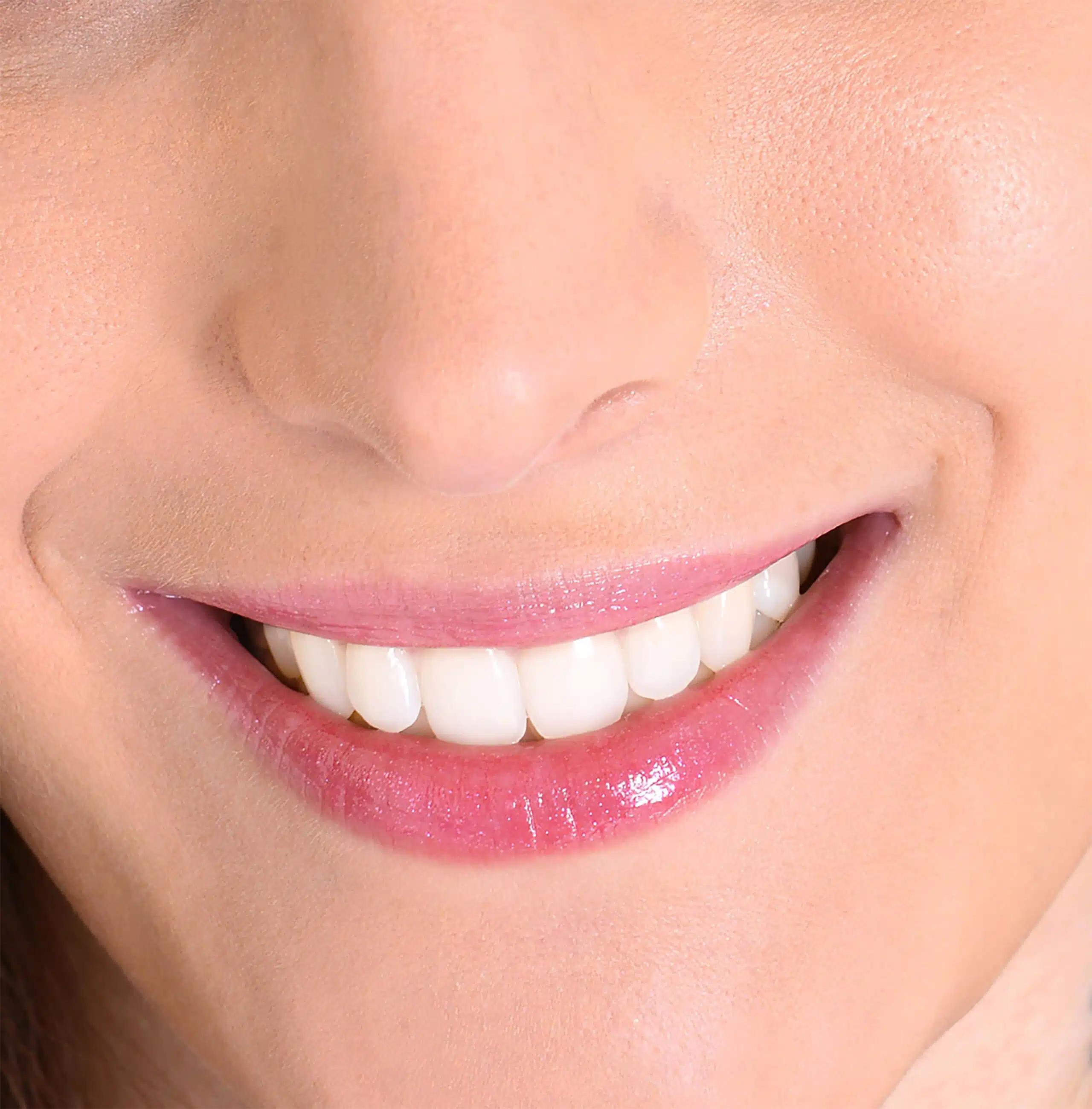 Improve your smile’s appearance with veneers.  We will work with you to make sure that your veneers give you the look you want.